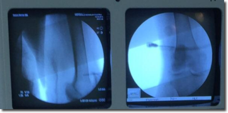 Figure 2, Treatment